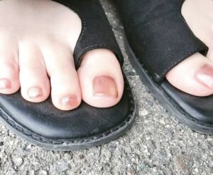 foot nail