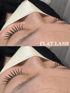 フラットラッシュ