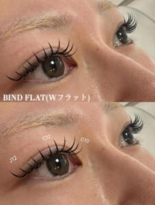 バインドフラット