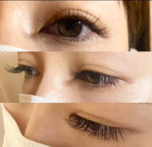 バインドフラット