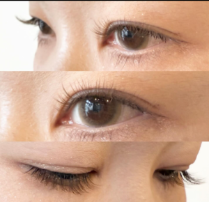 バインドフラット